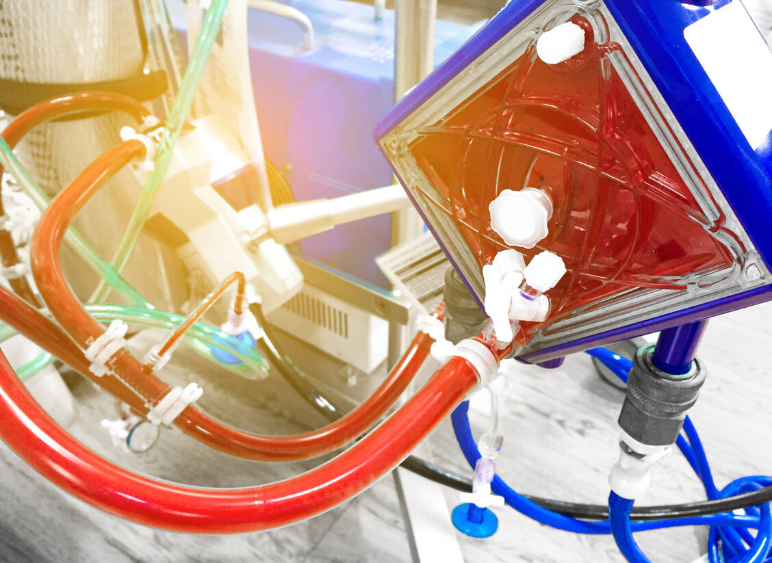 Wenn Patienten an eine künstliche Lunge angeschlossen werden müssen, steigt ihr Thromboserisiko deutlich. Hier soll ein neues Molekül Abhilfe schaffen, ohne das Blutungsrisiko zu erhöhen. / Foto: Getty Images/Tonpor Kasa