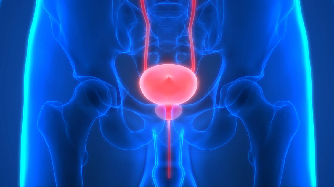 Weltweit ist Blasenkrebs die zehnthäufigste Krebserkrankung. Das Urothelkarzinom ist die häufigste Form von Blasenkrebs und macht etwa 90 Prozent aller Fälle aus. / Foto: Adobe Stock/magicmine