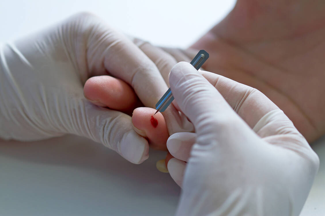 Beim Präventionsprojekt APOSCREEN-1 testen Apotheken Patienten auf Herz- und Nierenerkrankungen. Das Screening umfasst ein kurzes Gespräch, eine Blutdruckmessung sowie eine Kapillarblutentnahme und Urintests. / © Getty Images/pittawut
