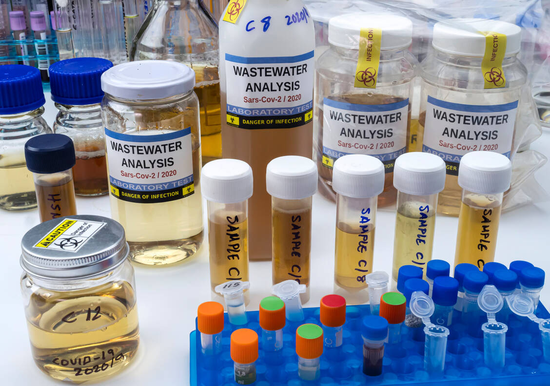 Unser Abwasser verrät Trends zur Ausbreitung von Krankheitserregern, nicht nur von SARS-CoV-2 inklusive seiner Varianten. / Foto: Getty Images/Science Photo Library/Digicomphoto