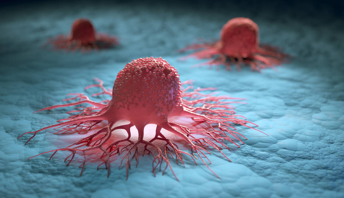 Neoantigene kommen ausschließlich auf Krebszellen vor. Das selektive Vorkommen versucht man, therapeutisch zu nutzen, indem man das Immunsystem durch aktive Immunisierung (Impfung) gezielt gegen diese einzigartigen Strukturen richtet.  / © Adobe Stock/peterschreiber.media