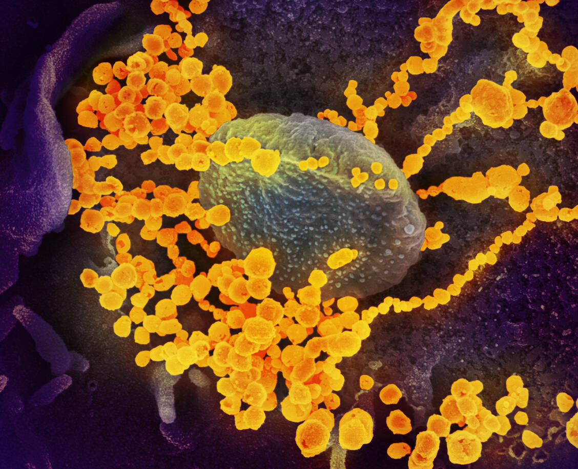 Das SARS-CoV-2-Virus ist nicht so hochsymmetrisch wie viele andere Viren  und kann in seinem Durchmesser zwischen 60 und 140 nm. / Foto: NIAID