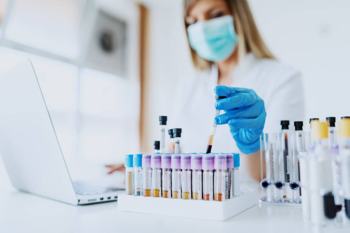Vor dem Einsatz von Eliglustat muss der CYP2D6-Metabolisierungsstatus des Patienten bestimmt werden. Bei ultraschnellem Metabolismus entstehen möglicherweise keine ausreichenden Wirkspiegel. / Foto: Adobe Stock/dusanpetkovic1