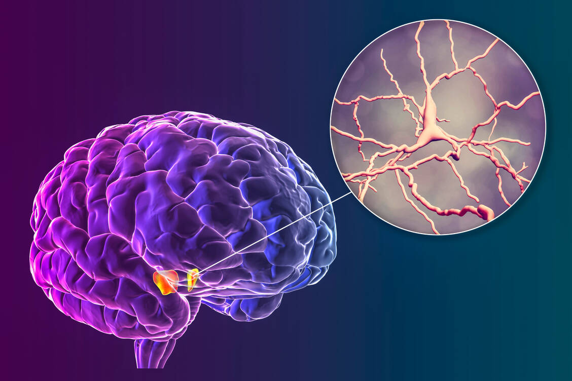Bei Morbus Parkinson kommt es zu einem Verlust dopaminerger Neuronen in den Basalganglien, was zu einer Hemmung motorischer Funktionen führt. / Foto: Getty Images/Dr_Microbe