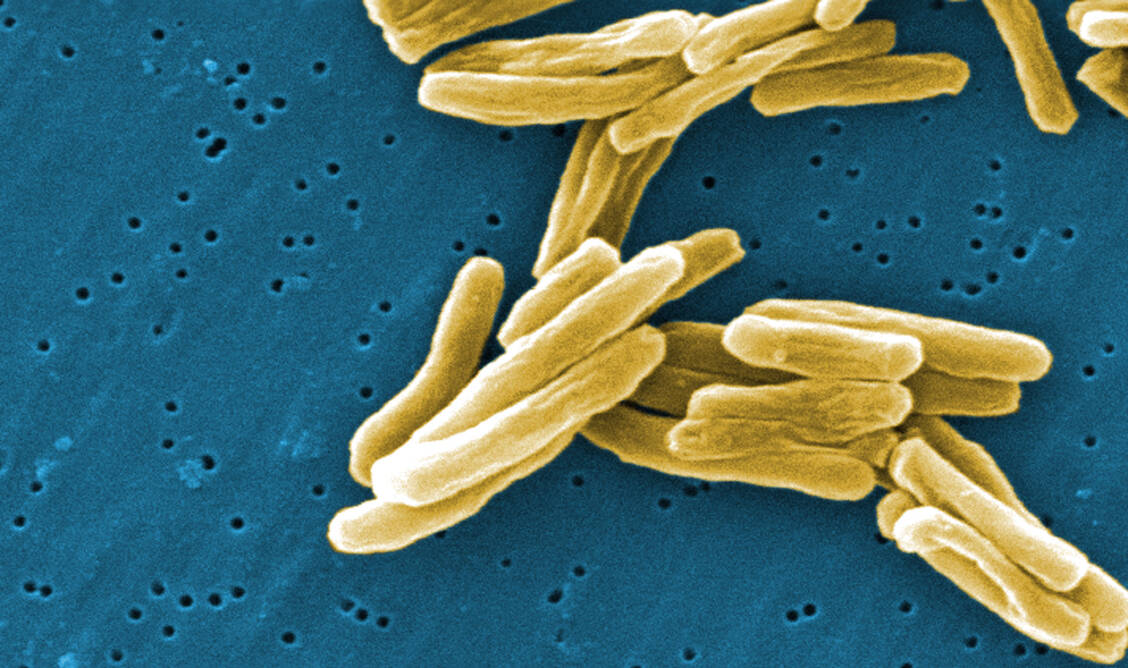 Stäbchenförmige Bakterien der Gattung Mycobacterium sind Erreger der Tuberkulose. / Foto: CDC/Ray Butler/Janice Haney Carr