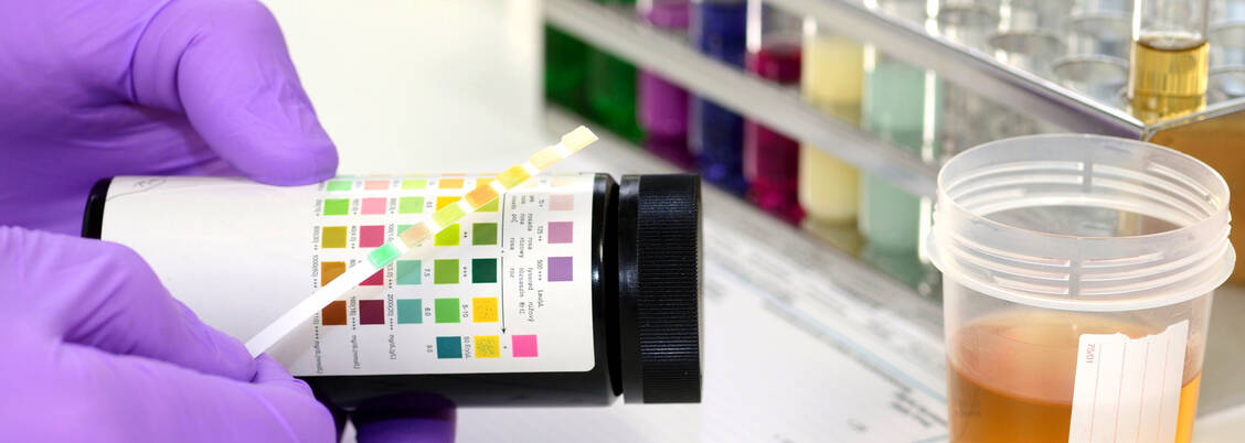 Eine Mikroalbuminurie gibt häufig den ersten Hinweis auf eine bislang unbemerkte Nierenschädigung. / © Adobe Stock/Gerhard Seybert