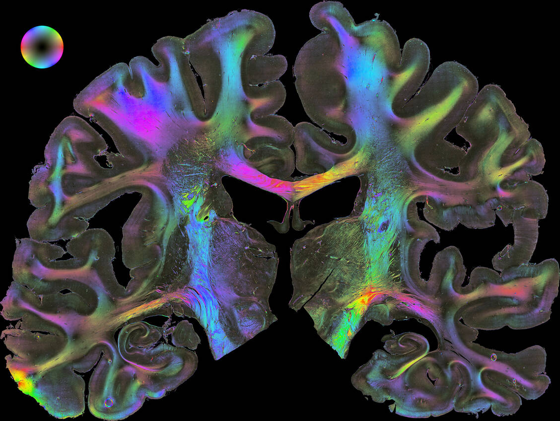 Das Human Brain Project hat in den vergangene zehn Jahren einen besonders detaillierte 3D-Karte des menschlichen Gehirns erstellt.  / Foto: Human Brain Project 
