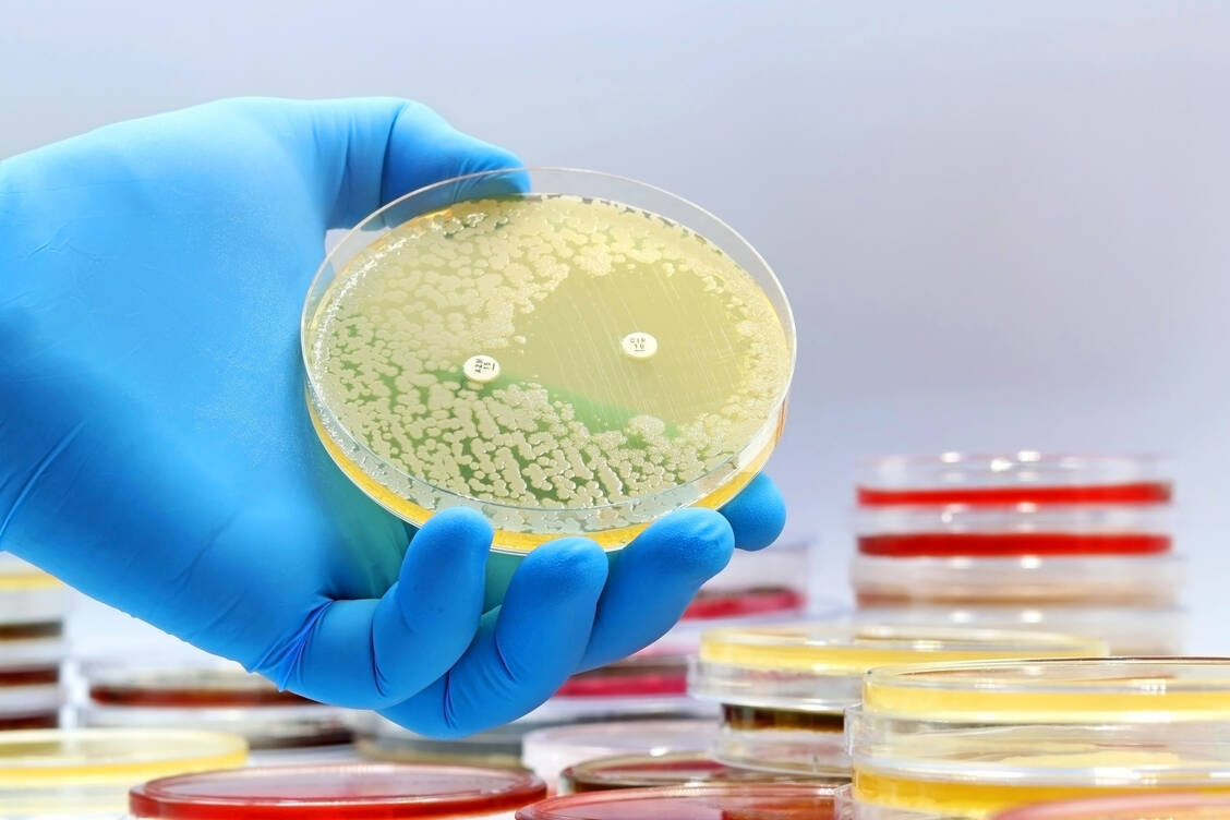 Für die Behandlung von Infektionen, verursacht durch multiresistente gramnegative Bakterien, stehen nur noch sehr wenige wirksame Therapieoptionen zur Verfügung. Die Zulassung von Aztreonam-Avibactam bietet daher eine neue und dringend benötigte Therapieoption / Foto: Adobe Stock/TopMicrobialStock