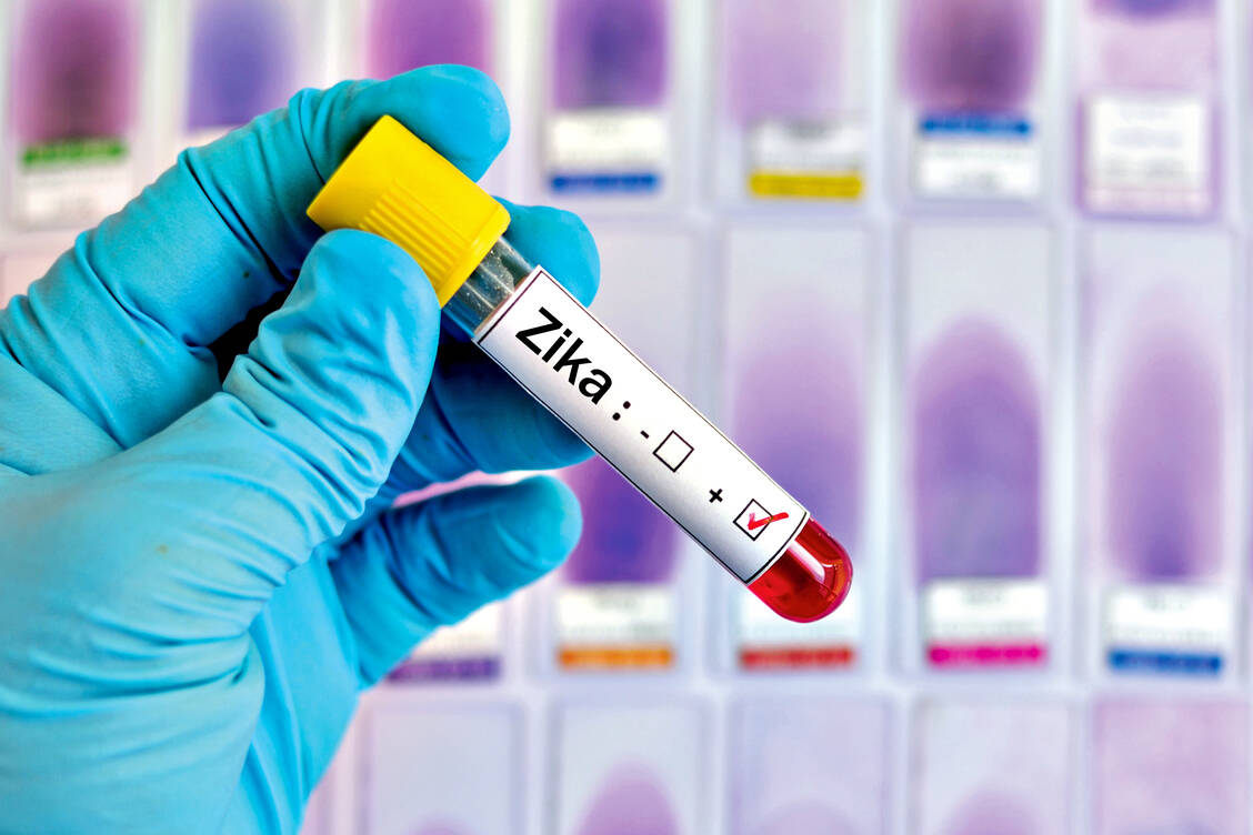 Eine Zika-Virus-Infektion in der Schwangerschaft kann das ungeborene Kind schwer schädigen. / Foto: Shutterstock/Jarun Ontakrai
