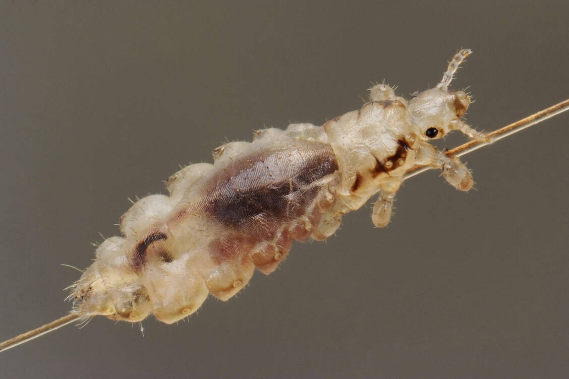 Die Beine der Kopflaus sind so ausgestattet, dass sie sich damit sehr gut an einem Haar festklammern kann. Hüpfen oder größere Entfernungen zurücklegen können die Parasiten nicht. / © Imago Images/Imagebroker