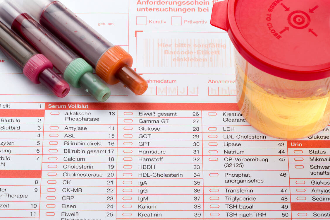 Der Cortisolspiegel wird im Blut oder im 24-Stunden-Sammelurin bestimmt. / Foto: Adobe Stock/Henrik Dolle
