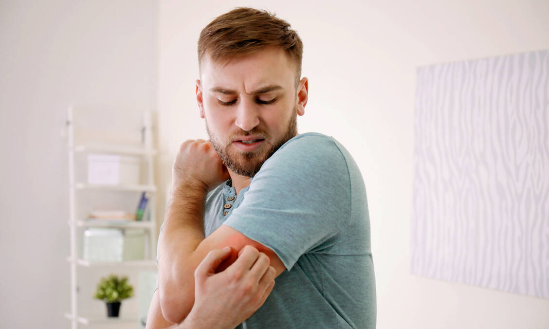 Viele Patienten mit atopischer Dermatitis leiden an starkem Juckreiz. Dieser wird durch Abrocitinib deutlich gebessert.      / Foto: Adobe Stock/New Africa