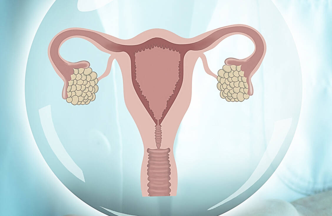 Erkrankt eine Frau an einem Tumor der Gebärmutter, handelt es sich meist um ein Endometriumkarzinom, also Krebs der Gebärmutterschleimhaut. / Foto: Adobe Stock/Artemenko_Daria