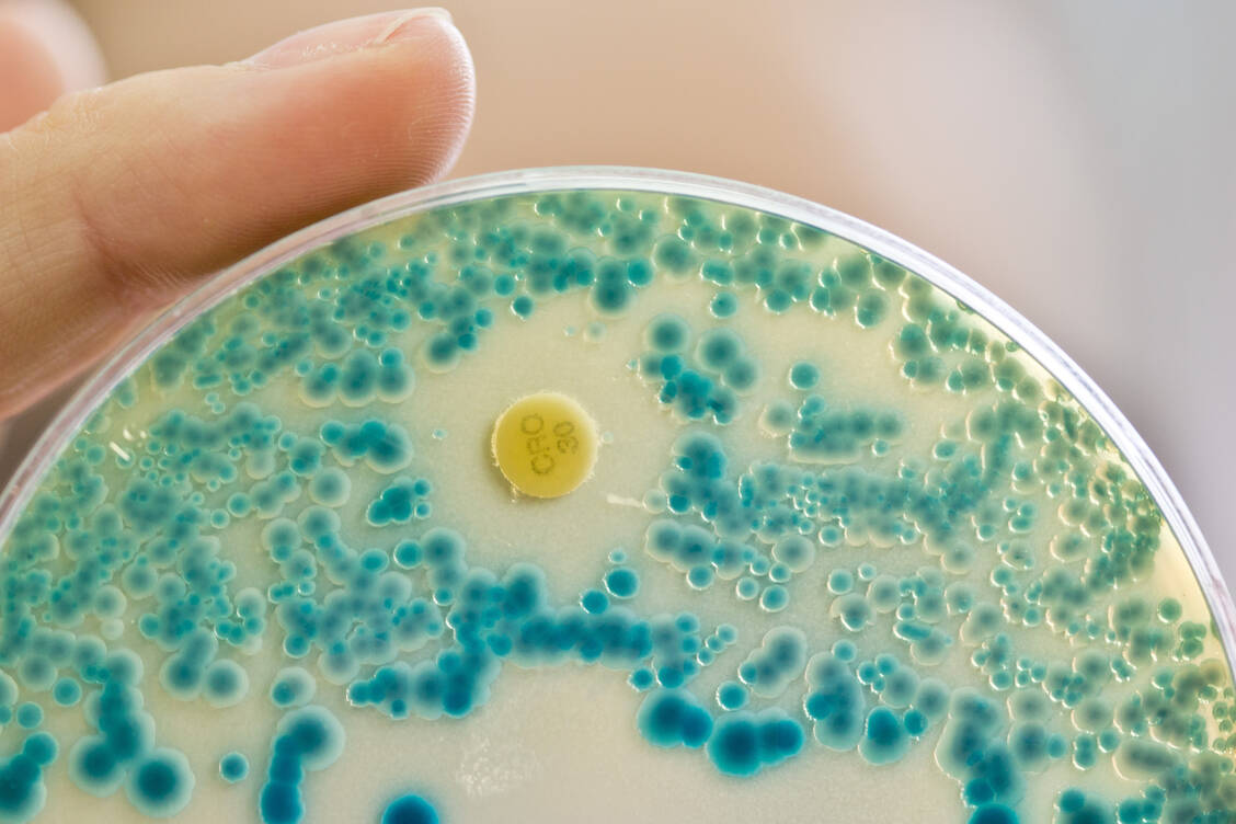 Die Mehrheit der antibiotikaresistenten Infektionen im Jahr 2019, die tödlich verliefen, beruhten auf einer Resistenz gegen Fluorchinolone oder Betalactam-Antibiotika.  / Foto: Picture Alliance / Daniel Karmann