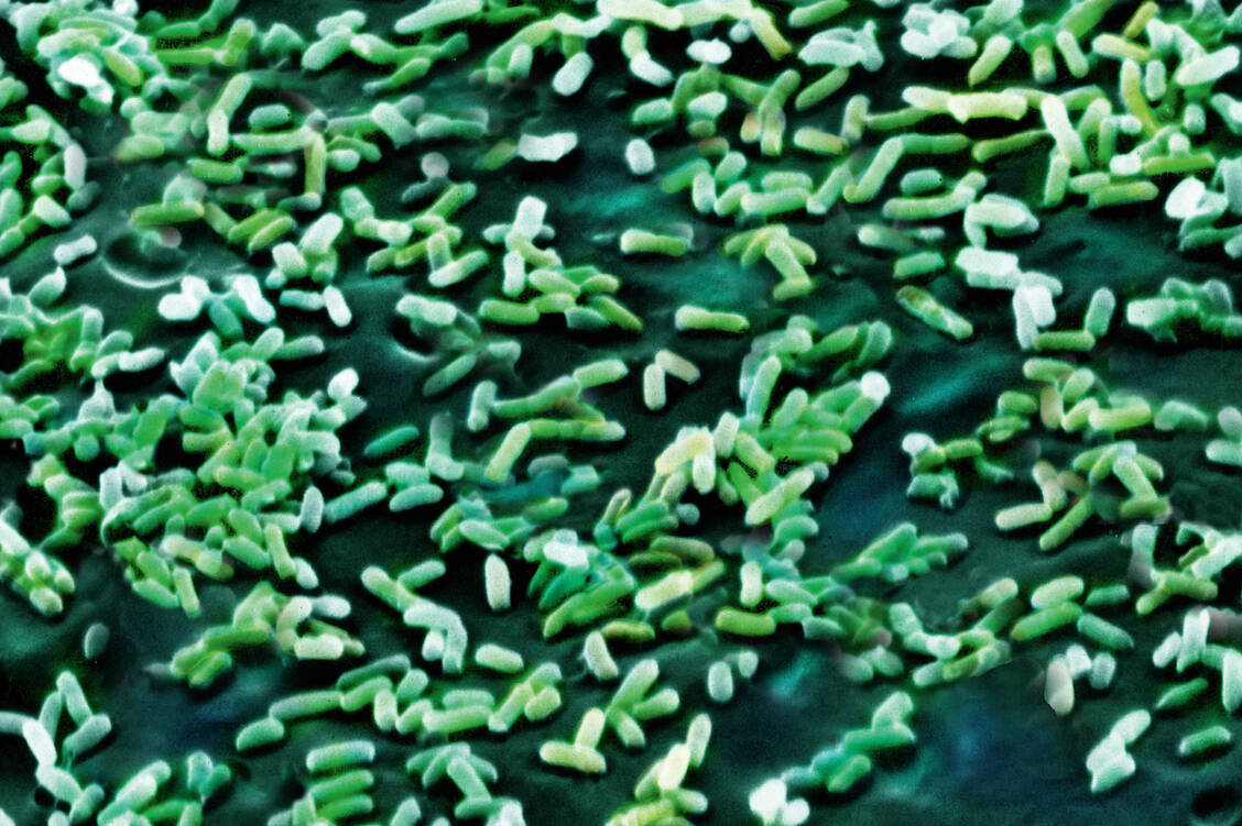 Escherichia coli mit Resistenzen gegen Cephalosporine der dritten Generation (3GCREC) sind Problemkeime, deren Bedeutung mittlerweile die von MRSA überholt hat. / Foto: OKAPIA/Biophoto Associates/NAS