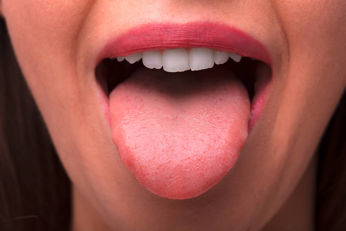 Auch das Mikrobiom im Mund und im Rachen scheint bei Covid-19 eine Rolle zu spielen, zeigen erste Studien. / Foto: Adobe Stock/Andrey Popov