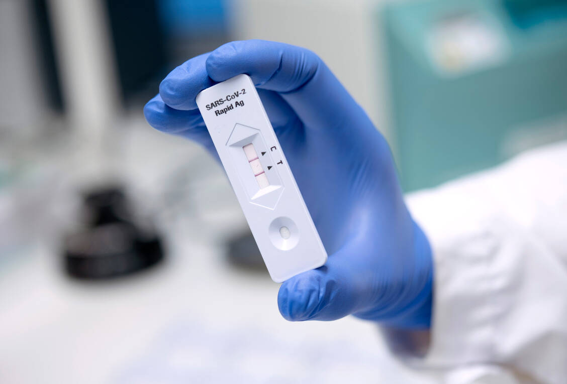 Bislang dürfen Apotheker Antigentests auf das Coronavirus nur an einen begrenzten Kreis abgeben.  / Foto: picture alliance/Johan Nilsson/TT