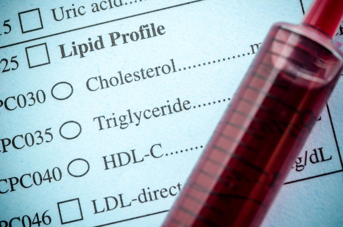Patienten mit familiärer Hypercholesterolämie haben oft trotz maximaler verträglicher Therapie einen zu hohen Cholesterolspiegel. / Foto: Adobe Stock/gamjai