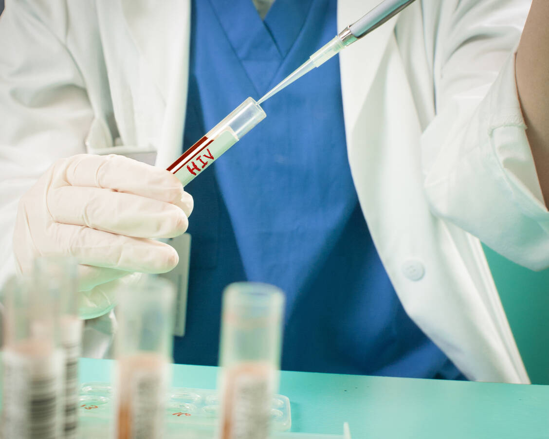 Noch immer wird auf dem Gebiet HIV viel geforscht. Nun hat man Proteine entdeckt, die wichtig sind für das Retrovirus, um in den Zellkern der Wirtszelle hineinzukommen. / Foto: Adobe Stock/ elmiguelito