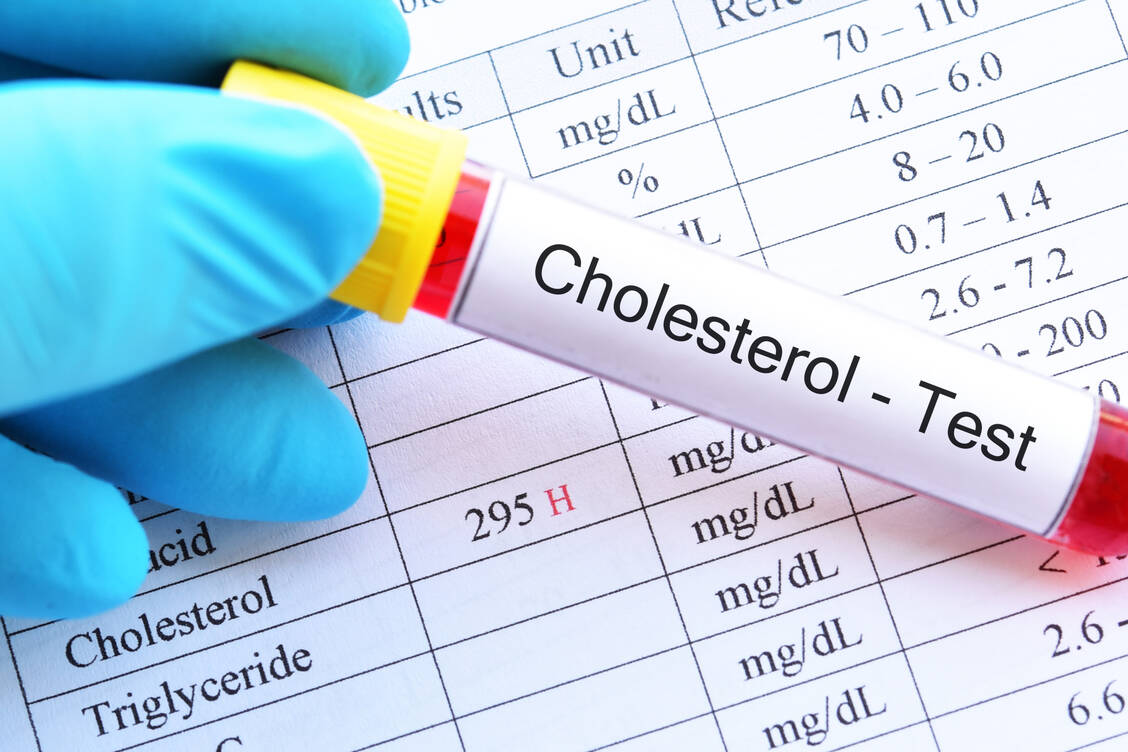 Entspricht der Cholesterolwert eines Patienten trotz maximal verträglicher Statindosis nicht den Zielvorstellungen, wird oft Ezetimib hinzugenommen. / Foto: Adobe Stock/ jarun011