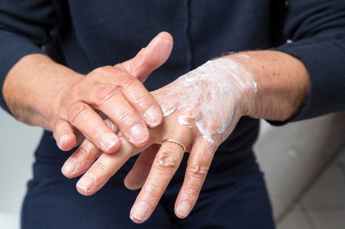 Regelmäßiges, mindestens zweimal tägliches Eincremen schont die Haut während einer Krebstherapie. / Foto: AOK-Mediendienst