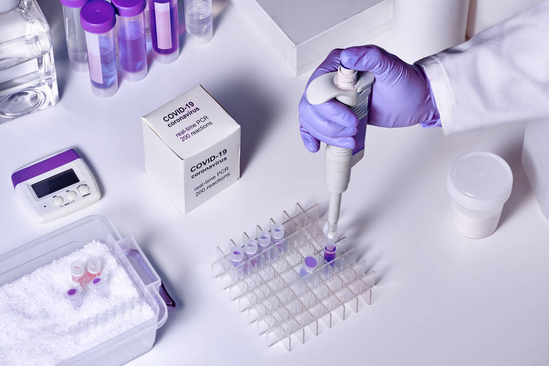 SARS-CoV-2-Infektionen lassen sich durch Methoden, die das Virusgenom erkennen oder die spezifische Antikörper detektieren, nachweisen. / Foto: Getty Images/anyaivanova