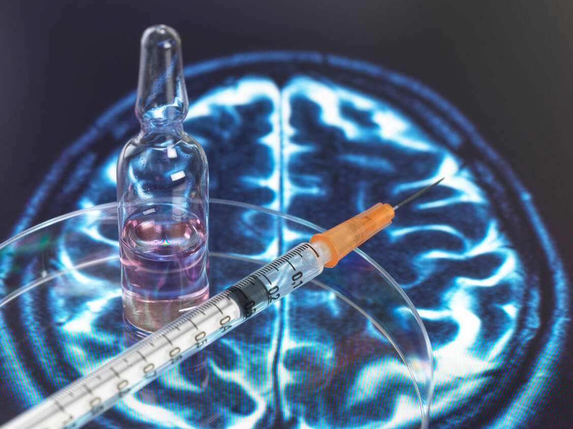 Lecanemab wird als intravenöse Infusion alle zwei Wochen verabreicht. Nebenwirkungen, vor allem Anomalien in der Bildgebung, müssen streng überwacht werden. / © Getty Images/Science Photo Library/TEK Image