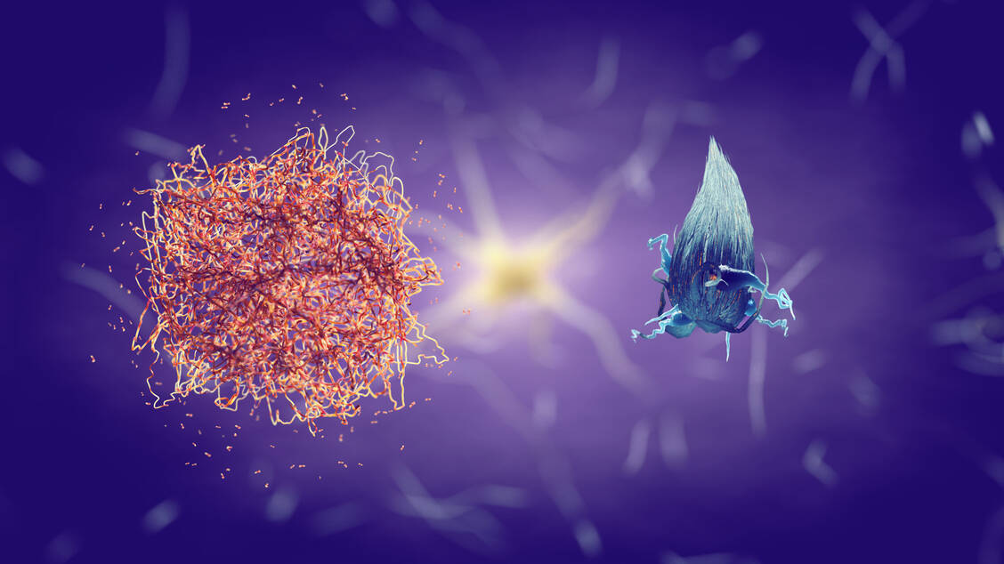Aggregate von fehlgefaltetem β-Amyloid in Plaques (links) und τ-Proteinen als Fibrillen sind Kennzeichen der Alzheimererkrankung. / Foto: Adobe Stock/nobeastsofierce
