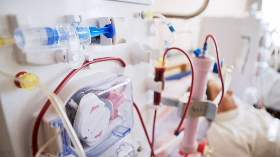 Ein akutes Nierenversagen ist potenziell lebensbedrohlich. Im Vordergrund der Intensivtherapie steht die Wiederherstellung der Flüssigkeits-, Elektrolyt- und Säure-Base-Homöostase. / Foto: Adobe Stock/procinemastock