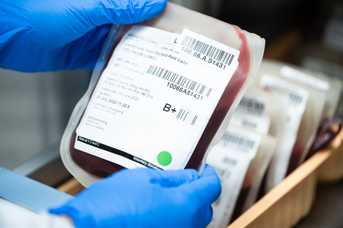 Die Gentherapie mit Exagamglogen Autotemcel kann Patienten mit Sichelzellenanämie oder β-Thalassämie heilen. Sie brauchen dann keine Bluttransfusionen mehr. / © Shutterstock/Komsan Loonprom