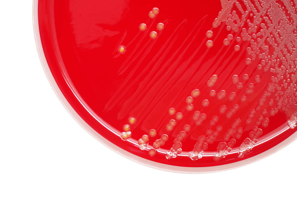 Das Bakterium Staphylococcus aureus ist weltweit einer der häufigsten Krankheitserreger, der schwere Blutstrominfektionen (Sepsis) verursachen kann. / © Adobe Stock/Chansom Pantip