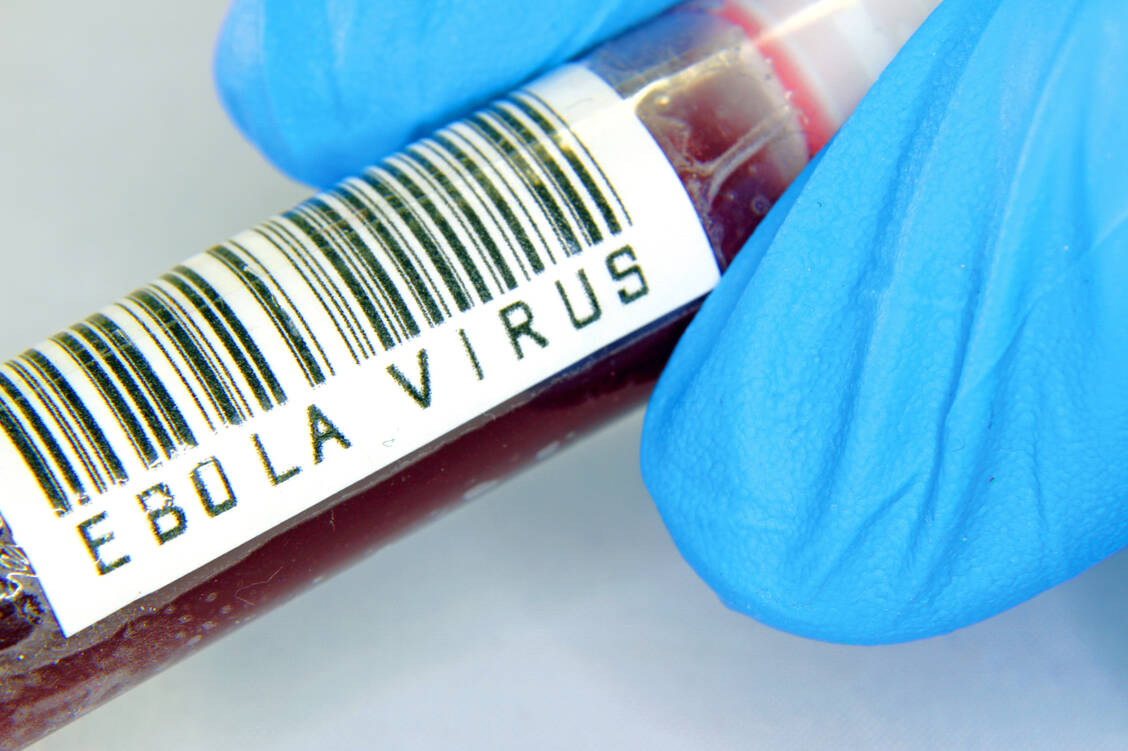 Ebola-Viren können bei Infizierten ein hämorrhagisches Fieber auslösen. / Foto: Shutterstock/ChiccoDodiFC