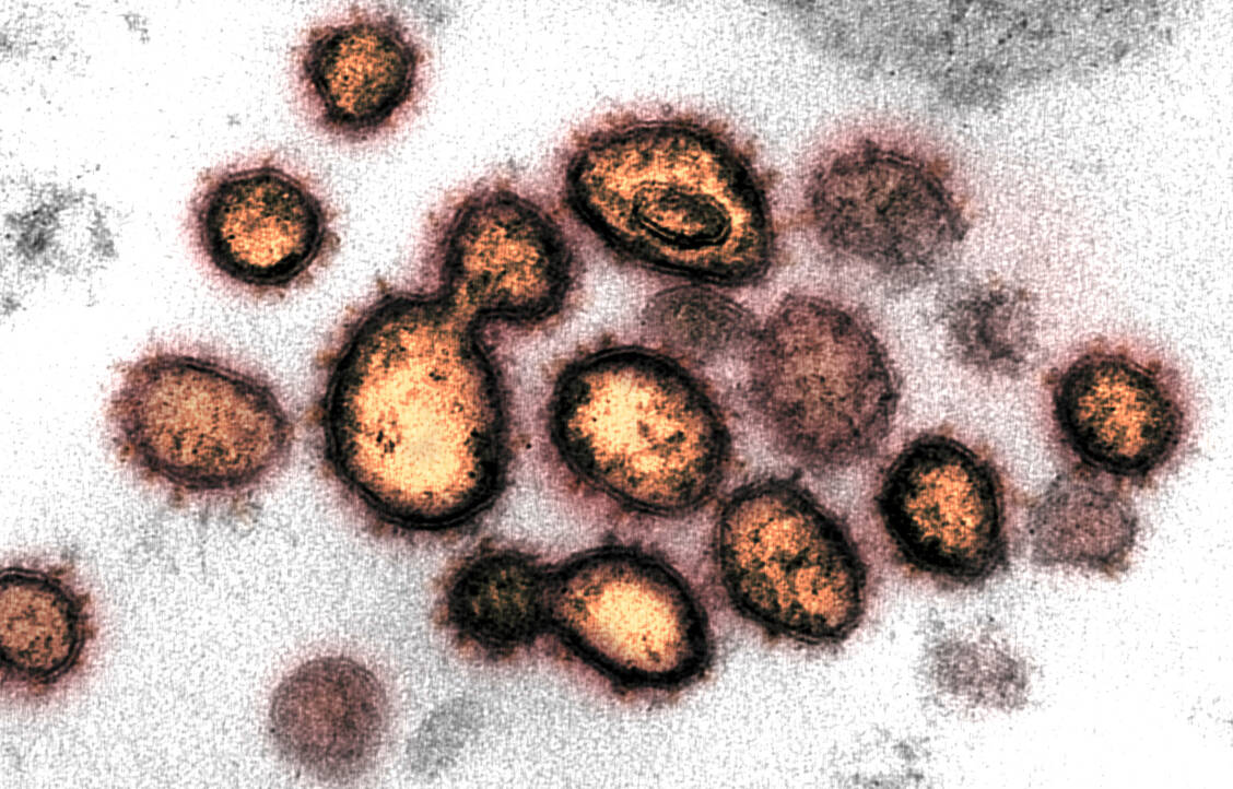 Der Erreger selbst – in diesem Fall das Pandemievirus SARS-CoV-2 – bildet bei den Ganzvirus-Impfstoffen das Antigen. Zuvor wird ihm mit verschiedenen Methoden seine krankmachende Eigenschaft genommen. / Foto: NIAID