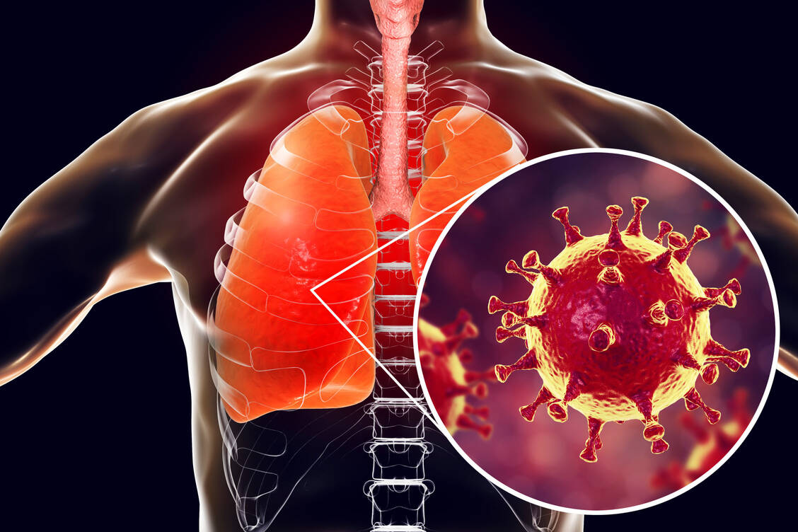 Die Inanspruchnahme eines zellulären Oberflächenproteins sowie Mutationen im Spike-Protein könnten der Grund dafür sein, weshalb Pirola deutlich leichter in Lungenzellen eindringen kann als andere SARS-CoV-2-Varianten.  / Foto: Getty Images/Kateryna Kon/Science Photo Library