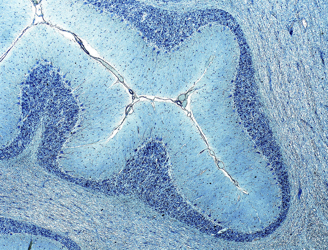 Die Graue Substanz, wie hier im Kleinhirn, sieht durch die enthaltenden Zellkörpern bei gefärbten Präparaten dunkler aus als die Weiße Substanz, die vor allem aus Nervenfortsätzen besteht. Foto: Imago/Science Photo Library