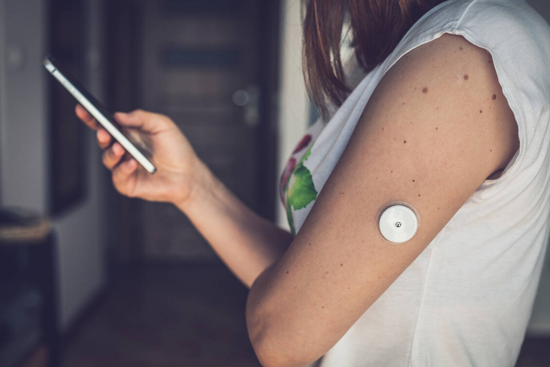 Insulinsensoren haften dank spezieller Pflaster tagelang auf der Haut. Sie können Hautirritationen oder Allergien hervorrufen. / Foto: Adobe Stock/Lukasz Szczepanski