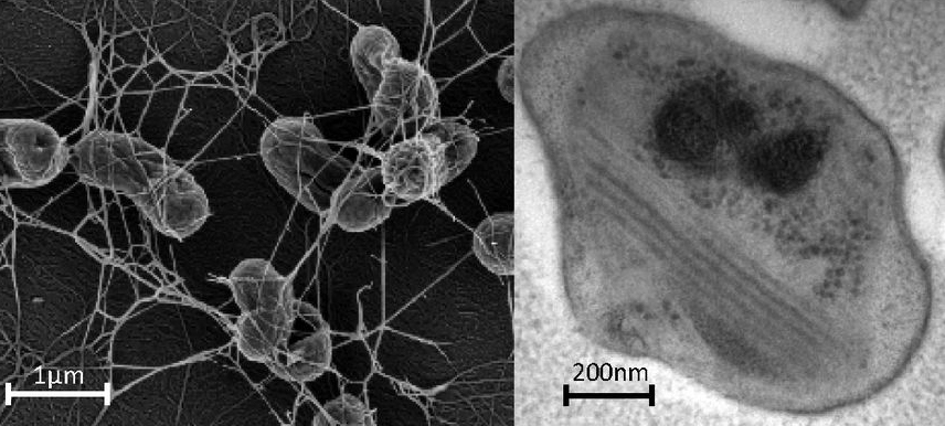 Das Bakterium Methylocapsa gorgona kann Methan aus der Luft abbauen. / Foto: PNAS/Tveit et al.