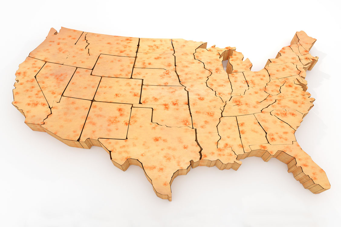 2000 galten die USA als masernfrei. Allein in diesem Jahr zählte die Gesundheitsbehörde jedoch bereits 695 Fälle, die vor allem in den Staaten Washington und New York auftraten. Aufgrund mangelnden Impfschutzes könnte sich die Erkrankung wieder über das ganze Land ausbreiten. / Foto: Adobe Stock/Aunt Spray