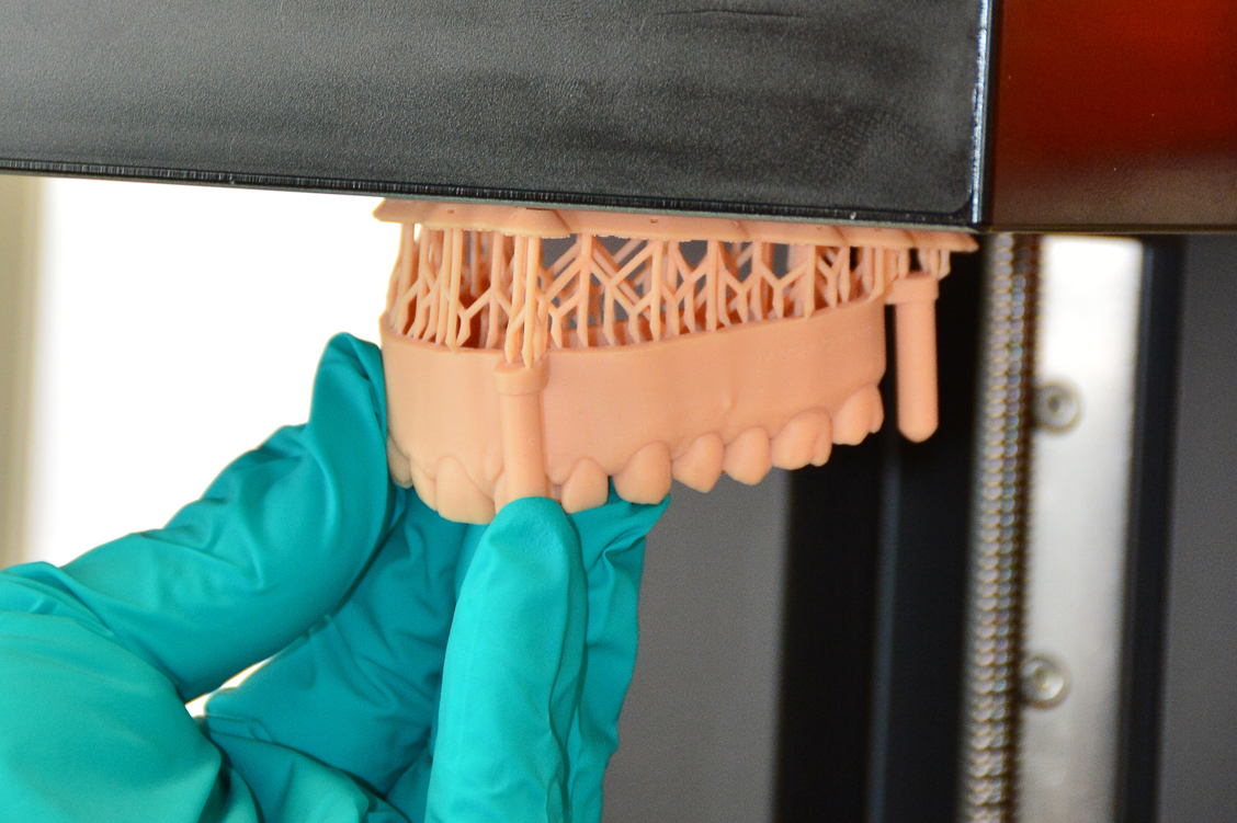 Zahnersatz wird bereits mithilfe des 3-D-Drucks hergestellt. In den USA gibt es auch ein zugelassenes Arzneimittel aus dem 3-D-Drucker. / Foto: Adobe Stock/JLO_Foto