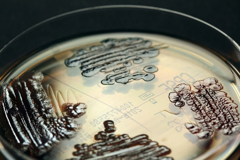 Die Zahl der Todesopfer durch multiresistente Erreger steigt – der Europäische Rechnungshof fordert deshalb den umsichtigen Einsatz von Antibiotika, eine Überwachung der Resistenzen sowie einen Ausbau der Forschung. / Foto: IMMIH, Kln/Hamprecht