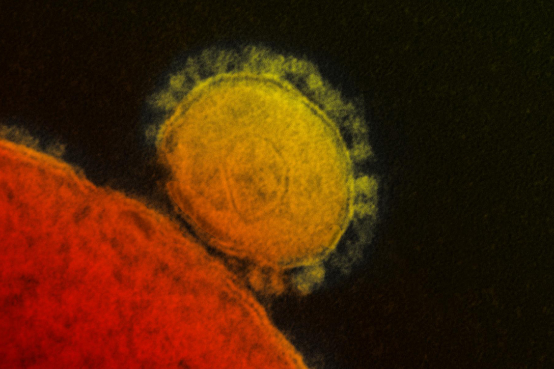 Glykoproteine auf der Oberfläche (hier das MERS-CoV) geben den Coronaviren ihren namensgebenden Kranz und sind essenziell für das Eindringen in die Wirtszelle. / Foto: National Institute of Allergy and Infectious Diseases (NIAID)