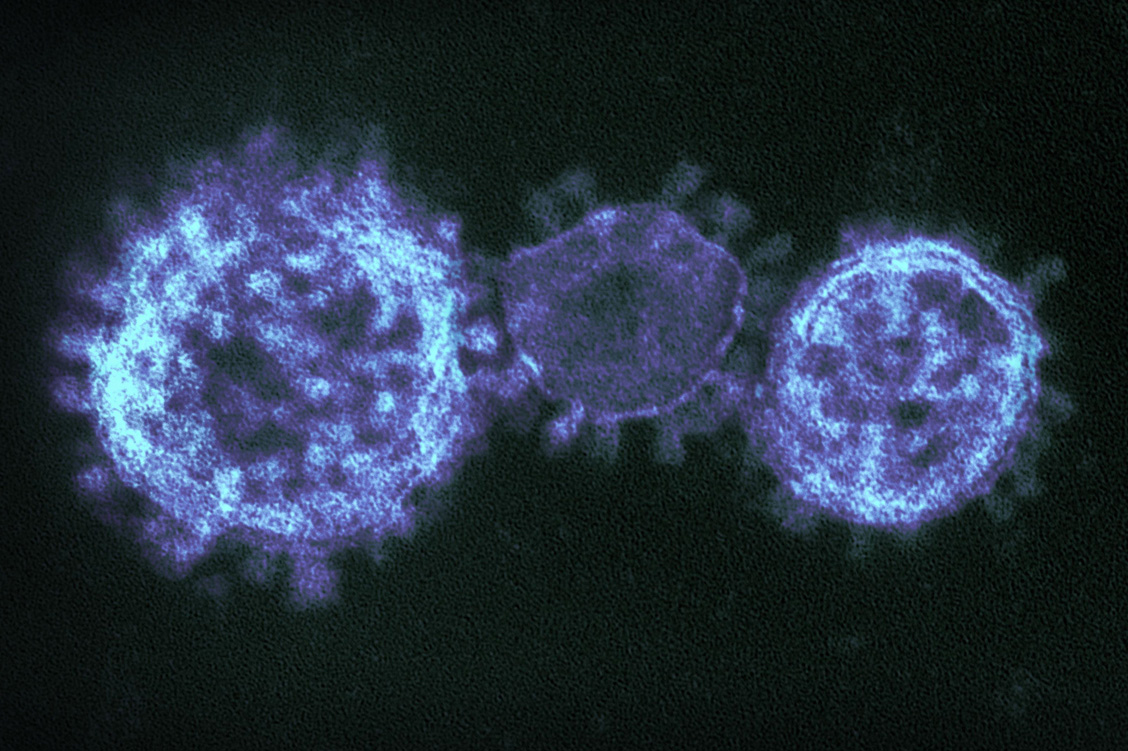 Der neue Erreger 2019-nCoV gehört zu den Coronaviren wie auch der SARS- und der MERS-Erreger, die schwere Atemwegserkrankungen verursachen. / Foto: National Institute of Allergy and Infectious Diseases (NIAID)