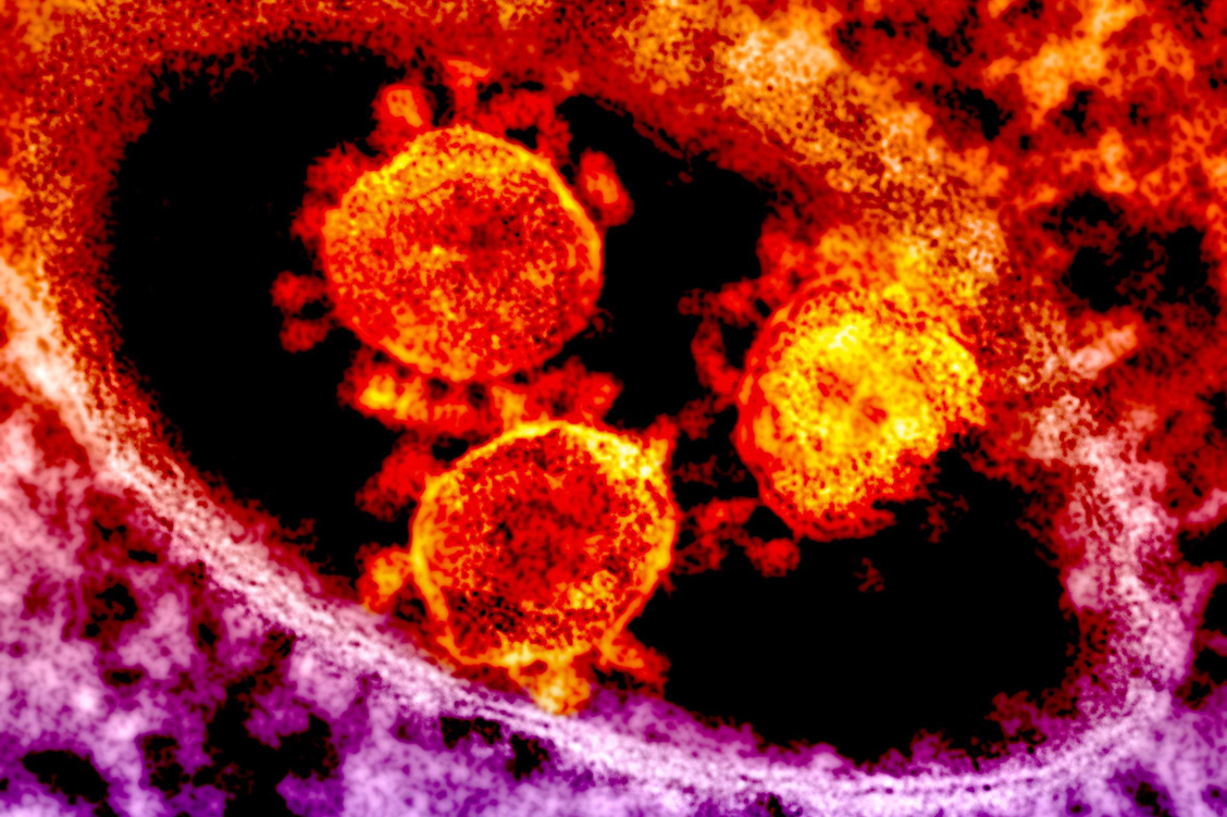 Alle Coronaviren haben einen namensgebenden Kranz aus Spike-Proteinen um ihre Hülle. Mit dem hier abgebildeten MERS-Erreger stimmt die genetische Sequenz des neuen Virus jedoch nur zu 50 Prozent überein. / Foto: National Institute of Allergy and Infectious Diseases (NIAID)
