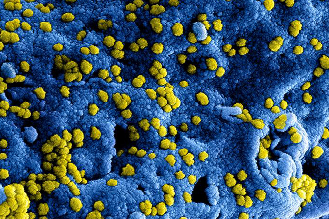 2019-nCoV gehört wie der Erreger von MERS und SARS zu den Coronaviren. / Foto: National Institute of Allergy and Infectious Diseases (NIAID)