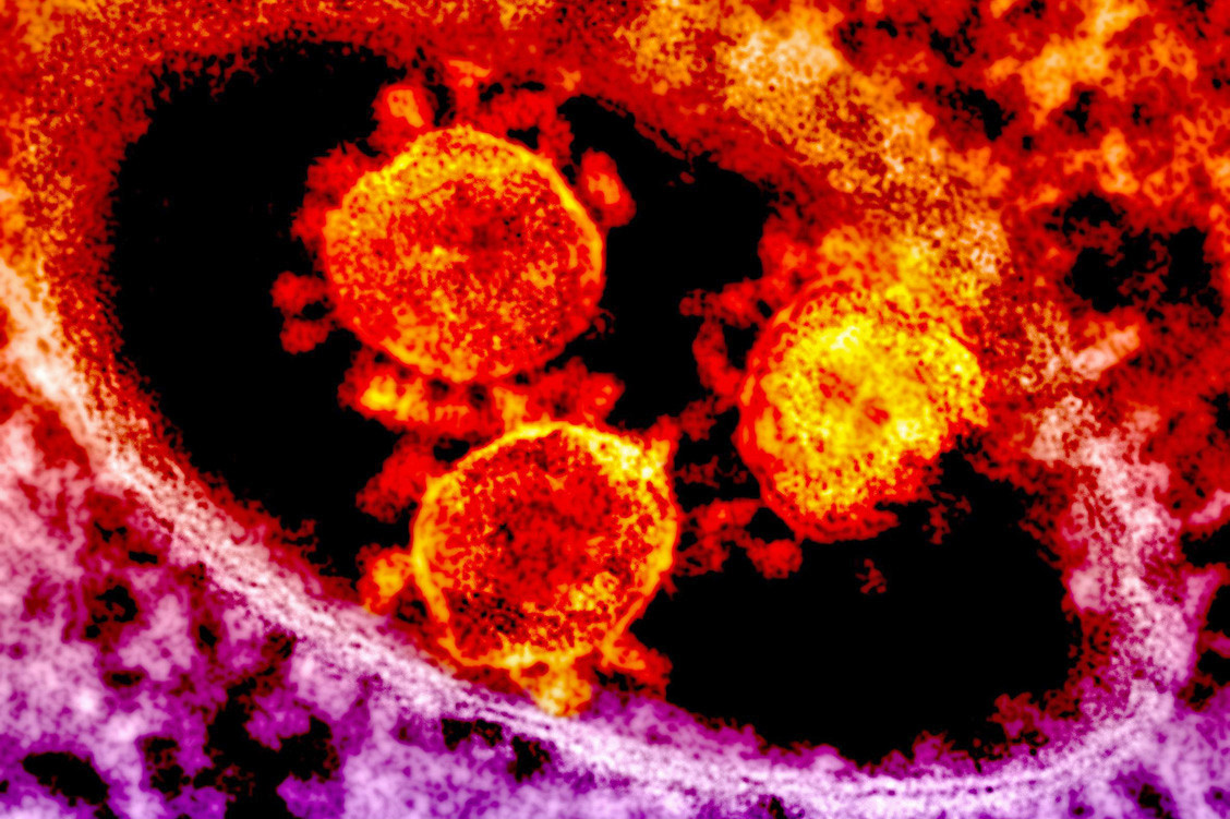 Auf der ganzen Welt ergreifen Regierungen Maßnahmen zur Eindämmung des neuen Coronavirus SARS-CoV-2. / Foto: National Institute of Allergy and Infectious Diseases (NIAID)