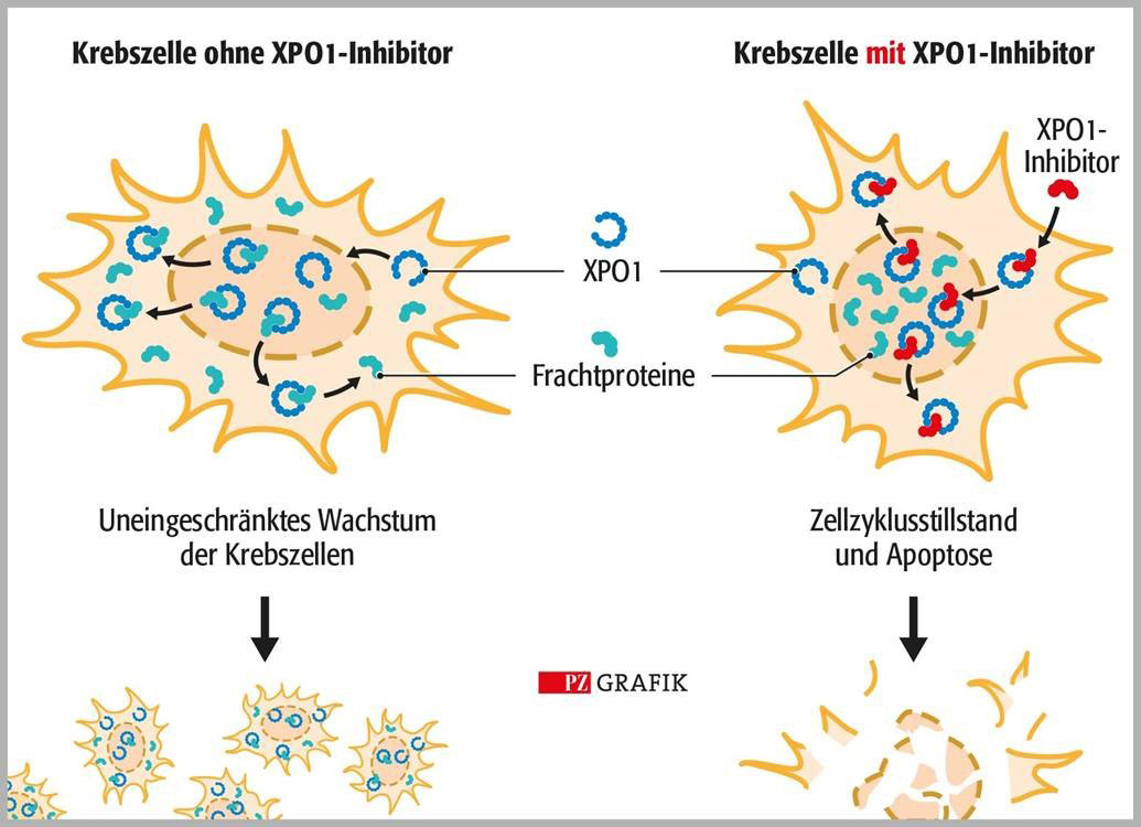 Selinexor hemmt das beim Multiplen Myelom meist überexprimierte Exportprotein XPO1, das normalerweise Proteine und RNA aus dem Zellkern ins Zytoplasma transportiert. Dies führt zum Stillstand des Zellzyklus und zur Apo­ptose von Krebszellen. / Foto: Stephan Spitzer