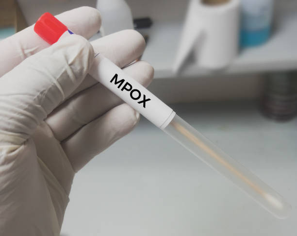 In Nordrhein-Westfalen wurde das Mpox-Virus bei einer vierköpfigen Familie nachgewiesen.  / © Getty Images/Md Babul Hosen