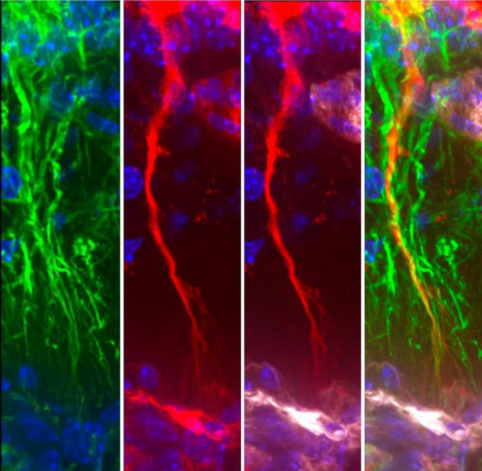 Tanyzyten (grün) nehmen Tau-Protein (rot) auf. / © Vincent Prévot, INSERM