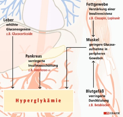 Pharmazeutische Zeitung online: Glucosetoleranzstörung: Nebenwirkung Diabetes